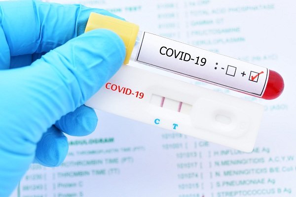Corrientes registró 56 nuevos casos de Coronavirus, 46 en Capital