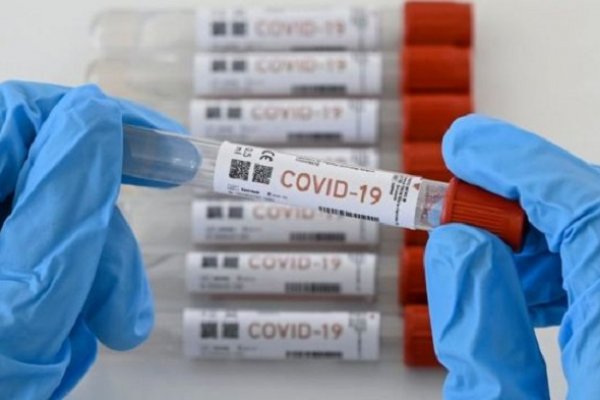 Coronavirus: Detectaron un caso en Ciencias Exactas
