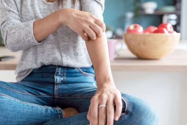 10 cosas que las personas con psoriasis deben saber