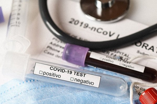 Nuevo récord de contagios: Confirmaron 160 casos de Coronavirus en Corrientes
