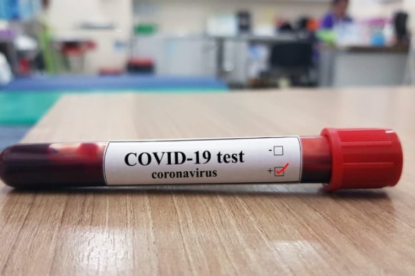 Pico de la pandemia: Corrientes registró 286 nuevos contagios de Coronavirus en un día