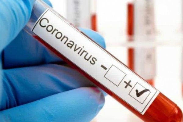 Cinco nuevos casos positivos de COVID-19 en Mburucuyá