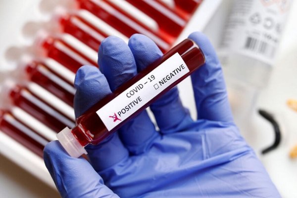 Récord: Corrientes registró 442 casos nuevos de Coronavirus