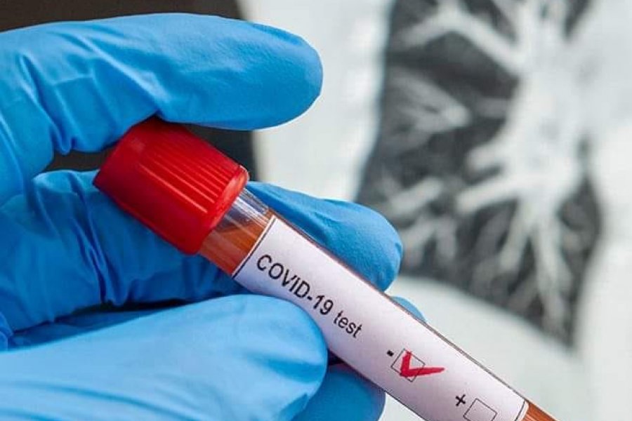 Nuevo caso positivo de Coronavirus en Mocoretá
