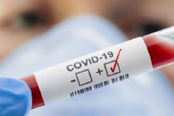 Con 46 nuevos positivos, Monte Caseros llegó a los 101 casos activos de Coronavirus