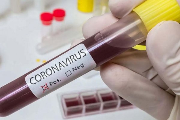 Un nuevo caso de Coronavirus y restricción de actividades en Concepción