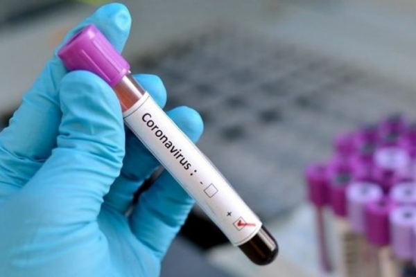 Coronavirus: 25 casos más en Monte Caseros y 10 en Virasoro