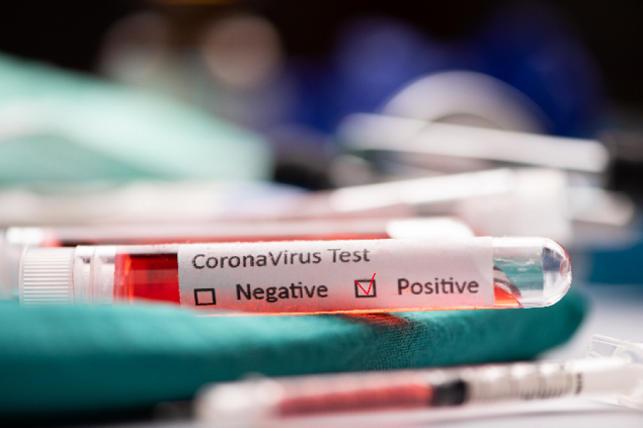 Covid-19: Detectaron 169 nuevos contagios en Corrientes