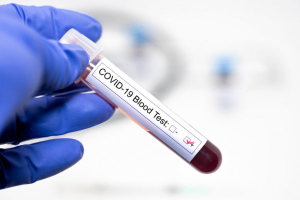 Corrientes registró 146 contagios nuevos y superó los 1.000 casos activos de Coronavirus