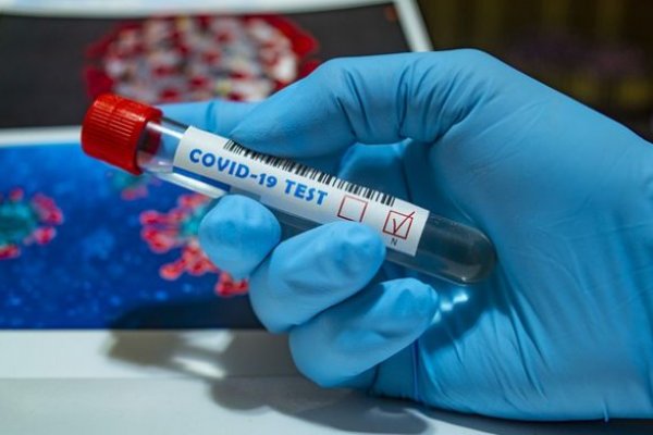 Corrientes: Detectan 160 casos nuevos de Coronavirus