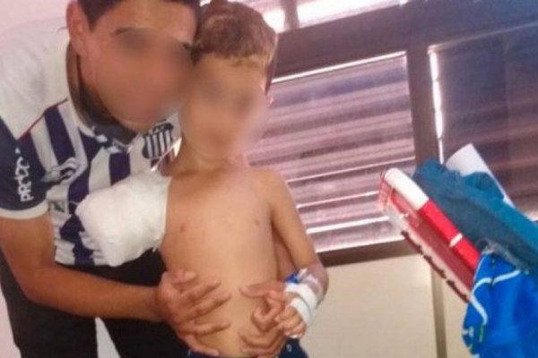 Un nene perdió el brazo derecho tras meterlo en un secarropas