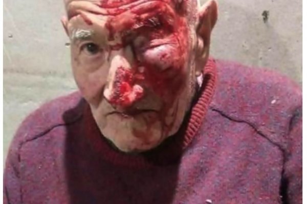 Dejaron inconciente a un anciano tras un violento asalto