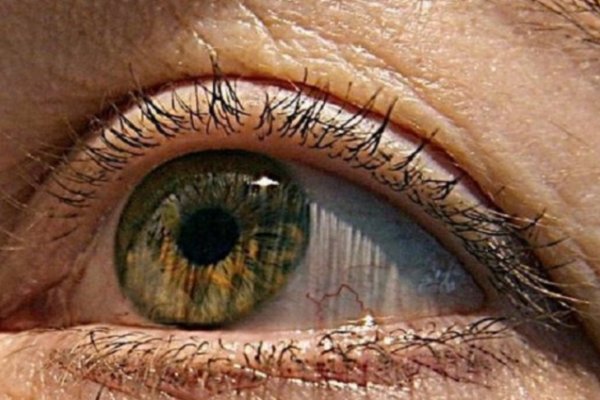 Un hombre ciego recobró parcialmente la vista con una terapia innovadora