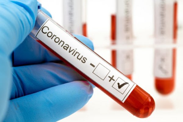 Detectaron 449 casos nuevos de Coronavirus en Corrientes