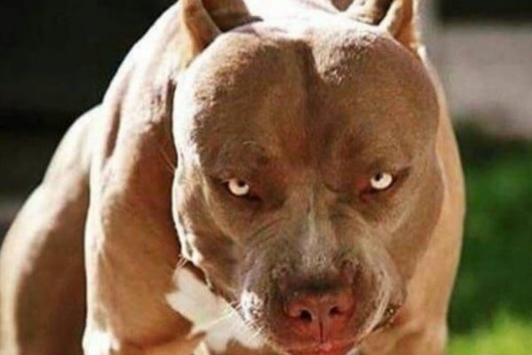 Brutal ataque de un pitbull a un niño de 5 años y su madre