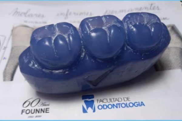 Tallado de dientes en jabón, una estrategia surgida en pandemia que favorece prácticas en odontología
