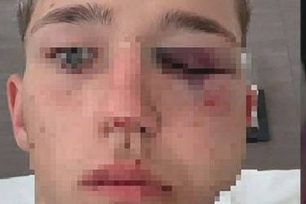 Imputarán a cuatro rugbiers en Salta por golpear a un adolescente