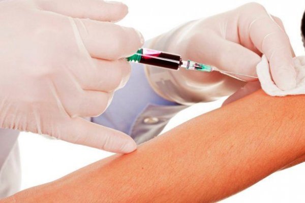Un test de sangre permite la detección temprana de 50 tipos de cáncer