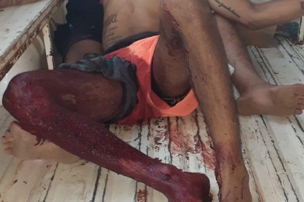 Sangriento ataque: Intentaron asesinar a un joven en el barrio Río Paraná
