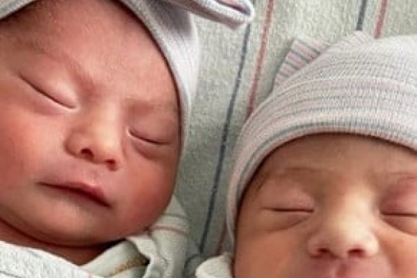Una mujer dio a luz a gemelos que nacieron en distinto año