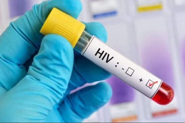 Prueban en humanos una vacuna contra el VIH