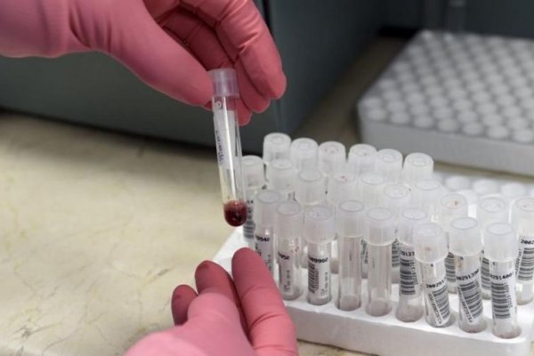 Una paciente con VIH tuvo covid y desarrolló 21 mutaciones del virus