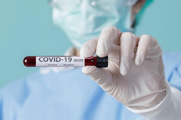 Covid: Detectaron 623 casos nuevos en Corrientes