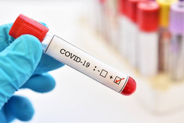Corrientes sumó 28 casos nuevos de Coronavirus
