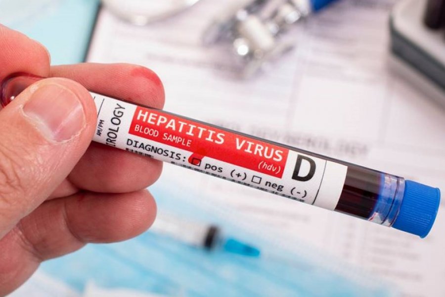 Hepatitis: Corrientes intensificó la vigilancia epidemiológica