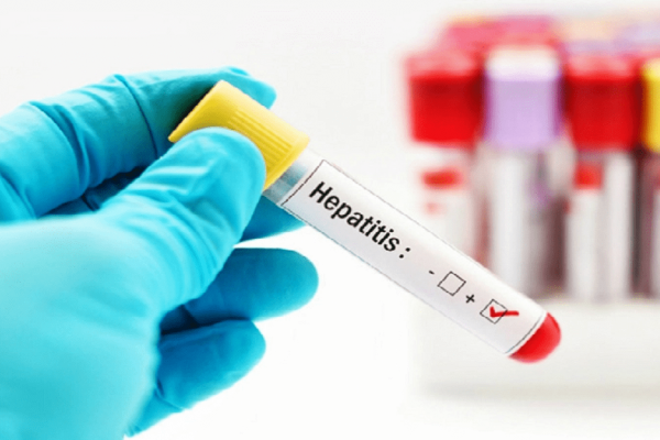 Alarma por una misteriosa hepatitis que afecta a niños en todo el mundo