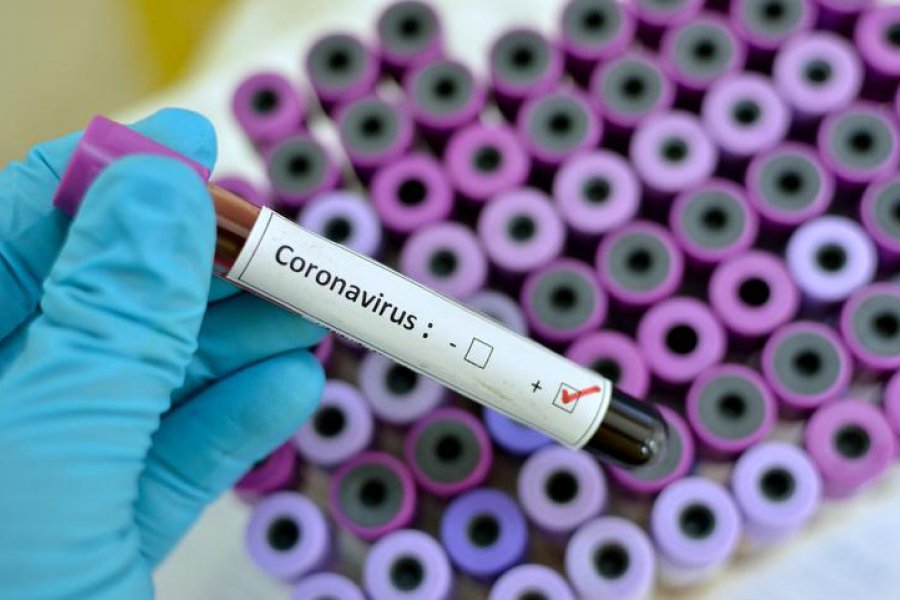 Corrientes acumula 99 casos activos de coronavirus