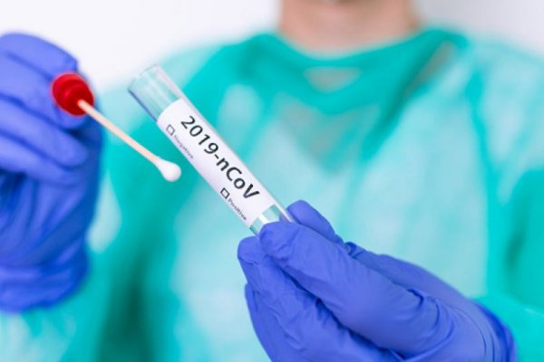 47 casos nuevos de Coronavirus en Corrientes
