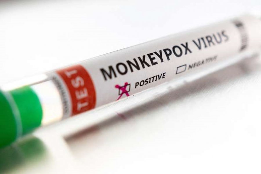 Se confirmó el primer caso de viruela del mono en el país