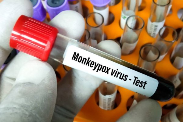 Quiénes tienen más probabilidad de contagiarse de la viruela del mono