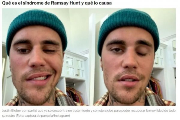 Justin Bieber: sufrió una parálisis en la mitad del rostro por un virus