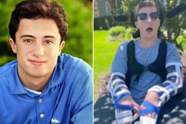 Joven quedó ciego, mudo y paralítico tras una fiesta universitaria en Estados Unidos