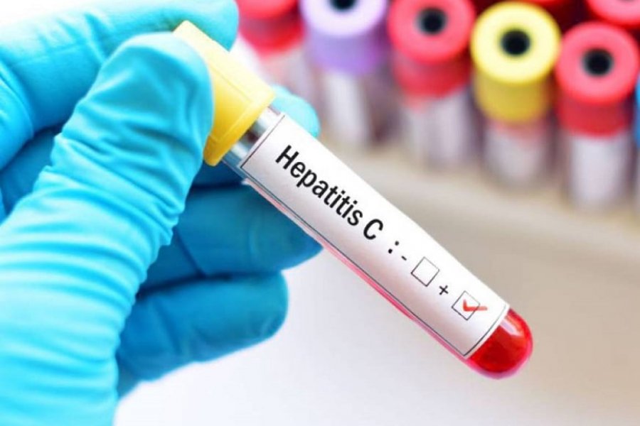 Solo el 18% de personas diagnosticadas con hepatitis B y C realizan tratamiento