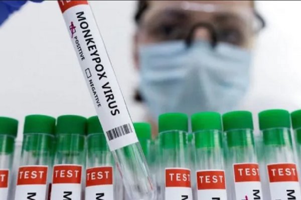 Confirmaron 170 casos de viruela del mono en siete provincias