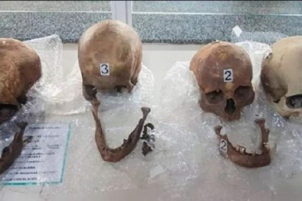 Formosa: Pasajera llevaba cuatro cráneos humanos en el equipaje