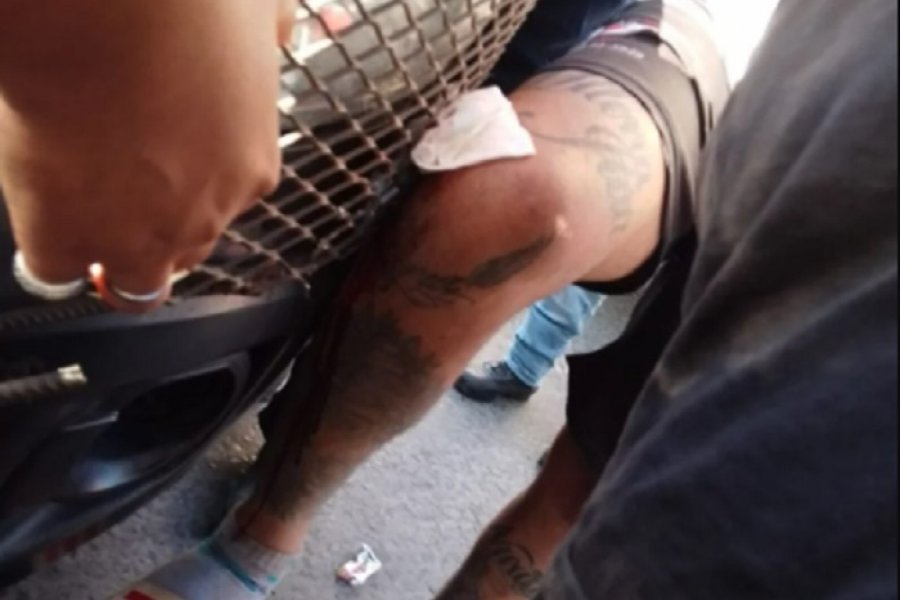 Corrientes: Un motociclista choco a patrullero y la reja quedó incrustada en su pierna