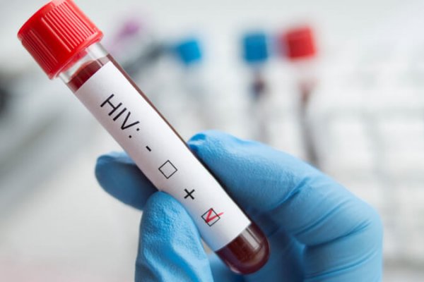 Avanza la cura del VIH con trasplantes de células madre
