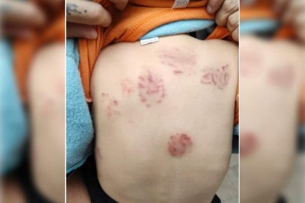 Denunció que su hijo fue atacado en un jardín maternal