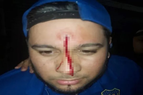 Impactante: balean a un cantante de cumbia correntino en pleno show