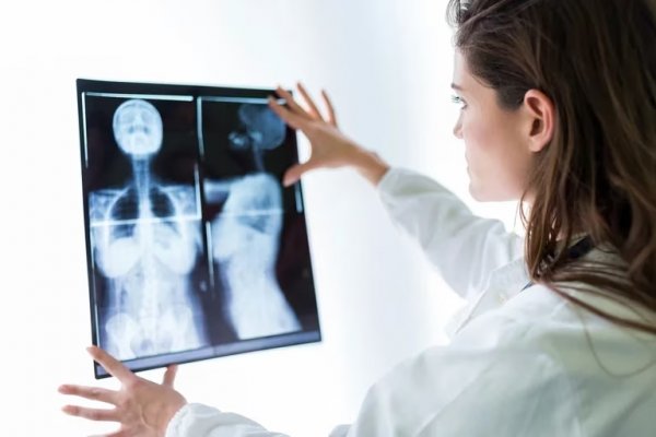 Cáncer: concientizar y actuar en la prevención