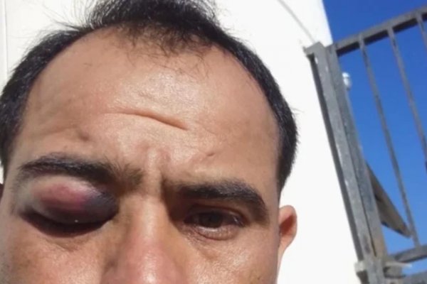 Otra vez violencia: un arbitro correntino fue atacado en pleno partido de fútbol