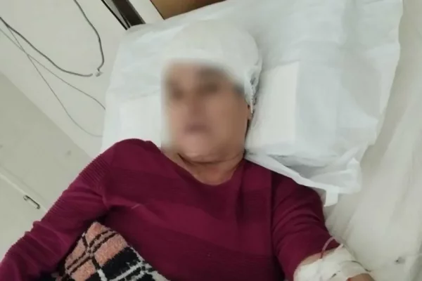 Corrientes: el crudo testimonio de una mujer que fue atacada a machetazos por el 