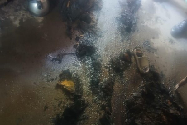 EN ESTADO GRAVE! Prendió un sahumerio y se quemó parte del cuerpo
