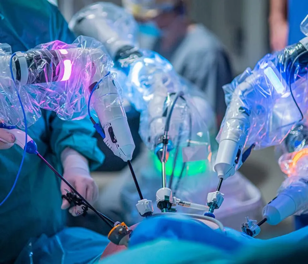 La inteligencia artificial transformó la cirugía robótica
