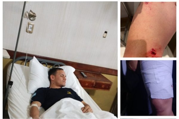 VIOLENCIA! Policías correntinos heridos durante una revuelta vecinal (IMÁGENES SENSIBLES)